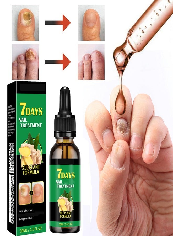 IMOLL Ginger Nail Treatment Nail Support Nail Care, 7days Nail Treatment, Ginger Nail Growth Serum, Ginger Cuticle Care Oil for Nails,Cuticle Serum for Nails (2Pcs, 1 Fl.oz(pack of 1)) - Image 3